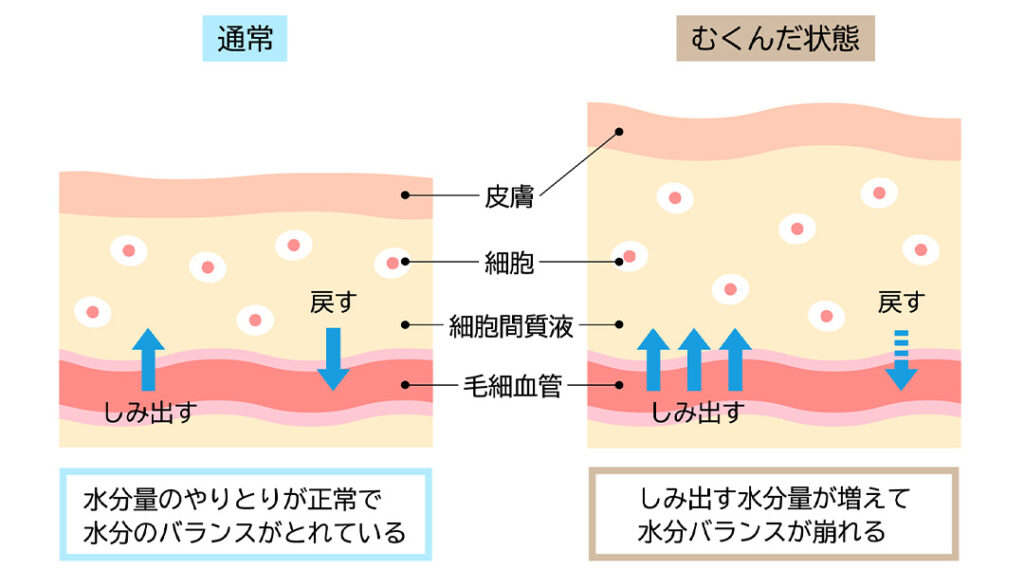 水分の取り方