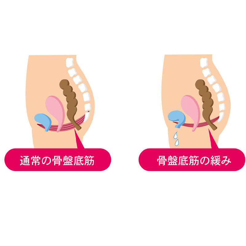 骨盤底筋　尿漏れ