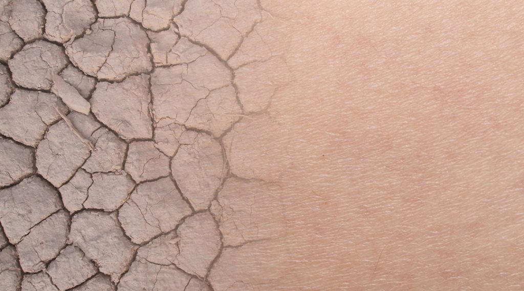 11月の乾燥した季節における肌のハリ